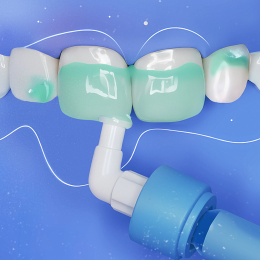 Инфильтрация