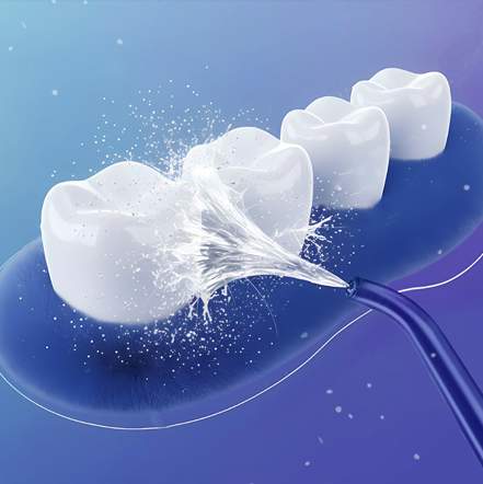 Ирригатор, ёршики или нить